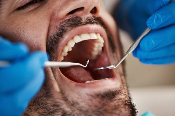 Best Pediatric Emergency Dentist in Colwich, KS